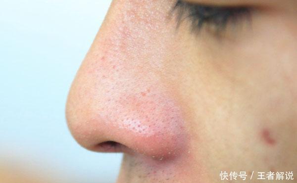 减肥|减肥吃代餐管用吗？坚持吃代餐，到底是变胖还是会变瘦？