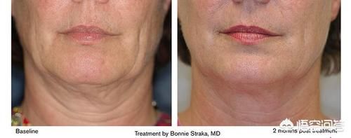 如何防止皮肤衰老、松弛和长皱纹？