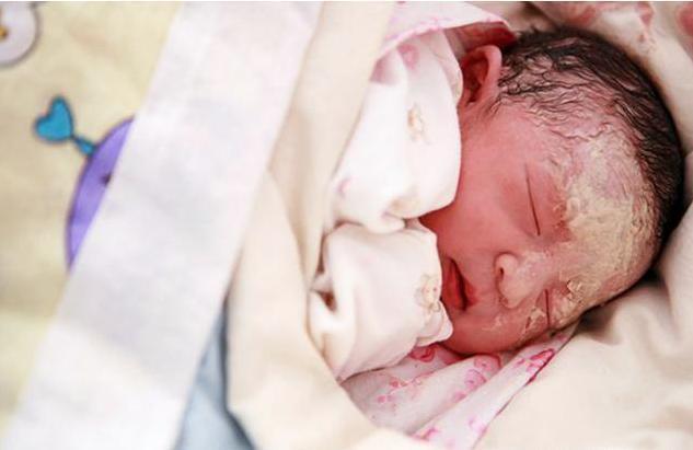 妈妈|“外星人宝宝”火了,刚出生丑哭宝妈,2个月后颜值成功逆袭