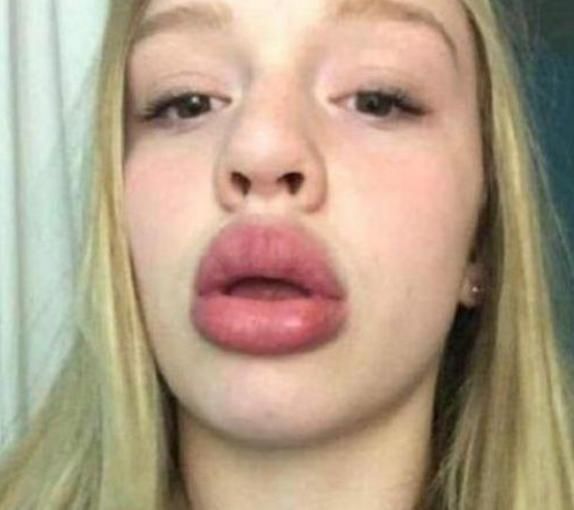 女孩子|女孩子想变“樱桃唇”,3个恶习趁早改,否则“火锅嘴”没人爱