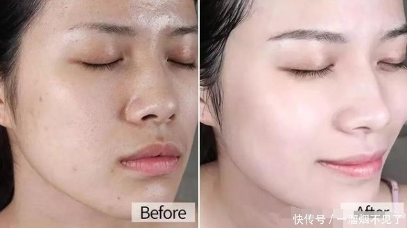 兰蔻|药店有一种不起眼的“精华液”,用后色斑皱纹全没了,堪称平价兰蔻