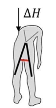 膝关节|这套“人造肌腱”装备，可保护你的老腰｜Science子刊