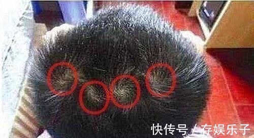 小伟|孩子头顶几个旋暗示着什么?别乱猜,科学的解释爸妈要牢记