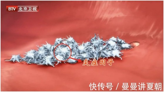 急性|这些炎症可能比癌症更可怕,发病快、致死率高