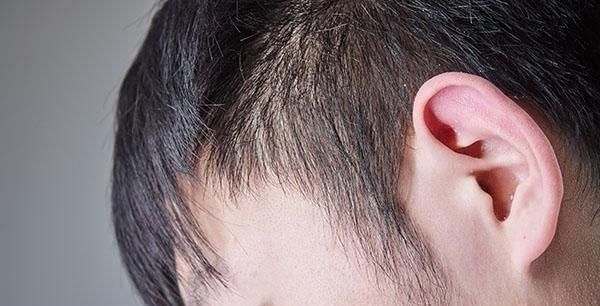 雄性激素|一个男性，如果体内雄激素旺盛，身体会有3个特征，希望你都有