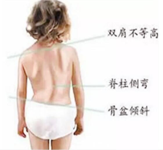 头颈部|家长这样抱宝宝,当心孩子以后高低肩,驼背,正确抱娃姿势要牢记