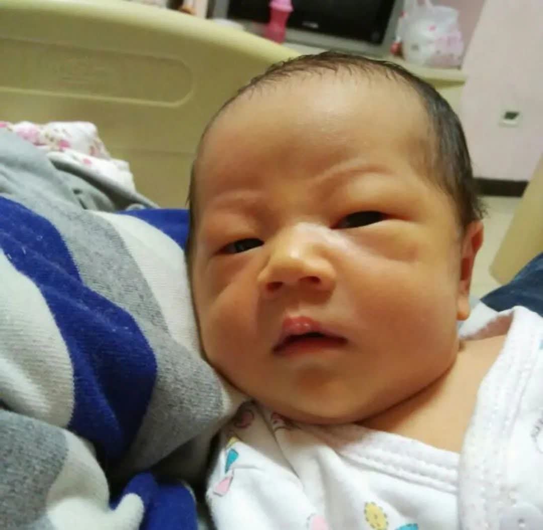 病理性黄疸|新生儿为什么会出现黄疸?该如何应对?关于黄疸你想知道的在这里