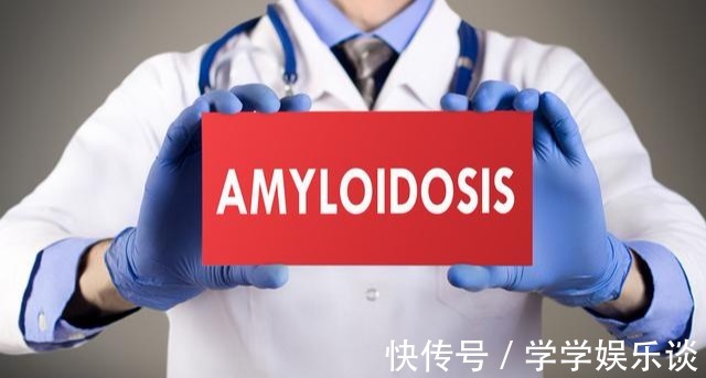 原发性肝癌|如何发现早期原发性肝癌这两点你知道吗