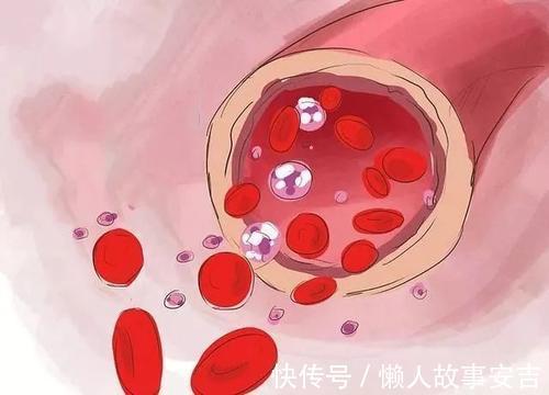 總膽固醇|警惕“沉默殺手”高血脂！中醫教授：帶你走出3大高血脂誤區