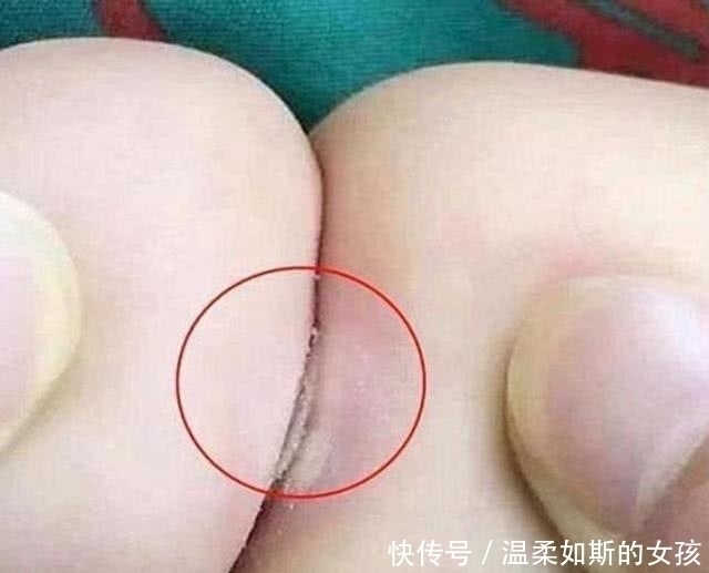 营养均衡|奶奶炫耀把孙子养的白胖,路人看后无奈:赶紧去医院看看吧