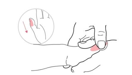 疾病|省立三院小儿推拿，“手”护健康