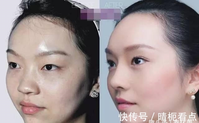 美白|实拍:10张女孩整容前后的对比照,这真就是换了一张脸