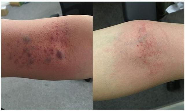 八虚|经络畅通病不找！拍拍这几处，疏通经络一身轻松！