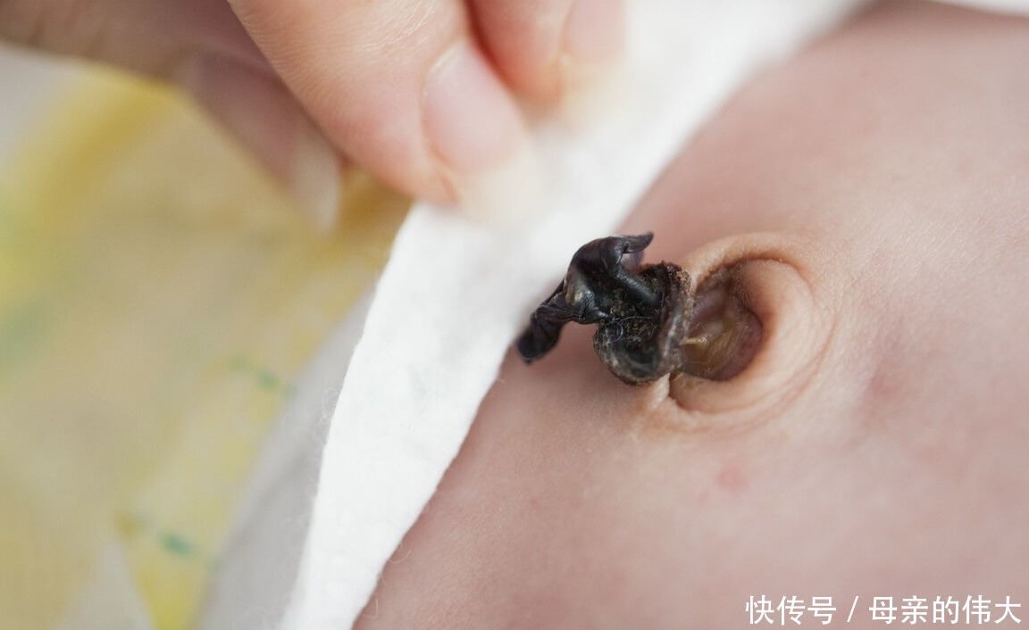 小宝宝|宝宝出生后新手父母手忙脚乱?有了这份清单,能让你从容面对