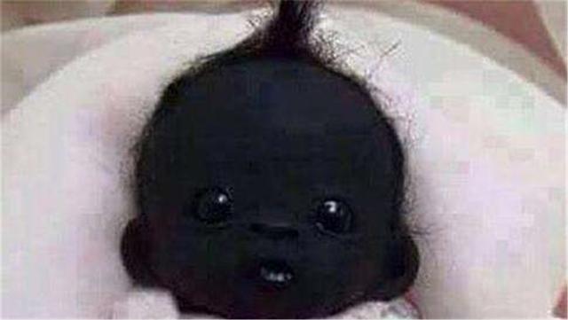 自卑|“世界最黑婴儿”如今5岁了,他变白了吗?网友:不愧是世界之最