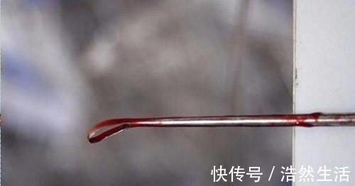 人流|女性一生能承受几次流产？流产十次仍能分娩的女人，是什么原因？