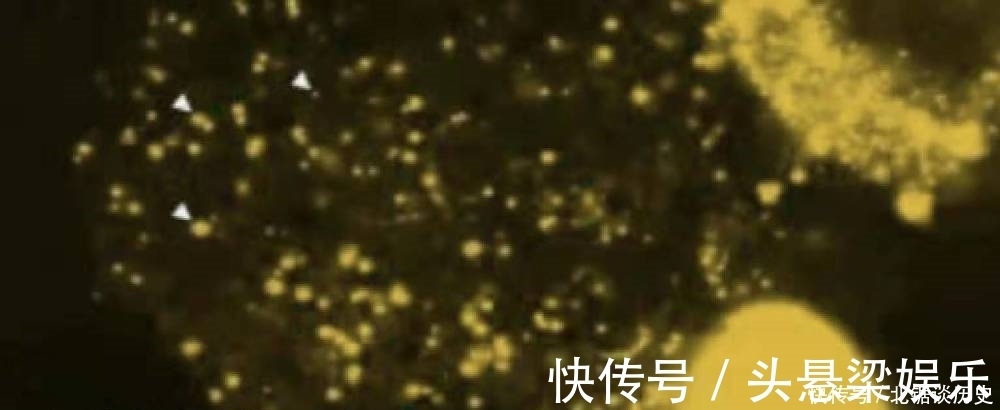 角质层|要想皮肤好,不仅要让肌肤垃圾代谢出去,更要让肌肤吸收好!