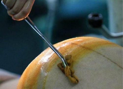 过程|剖腹产真的很轻松吗?看完“香蕉产妇”的分娩过程,或许你会改观