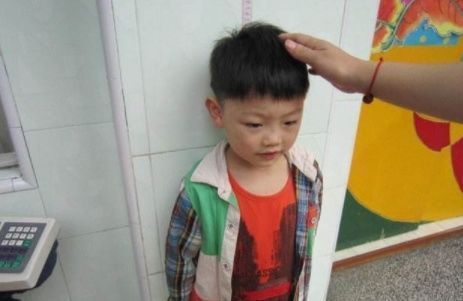 长高|孩子若出现这些特征,可能要停止长高了,家长尽量别忽视了