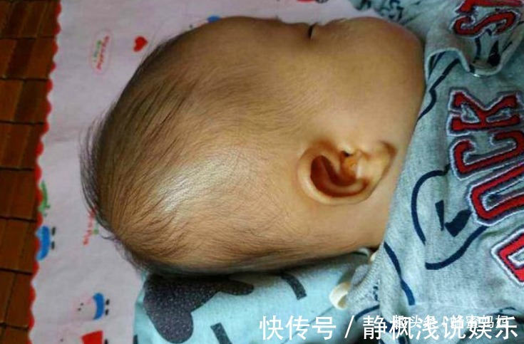 头型|小时候睡枕头和不睡枕头的娃,长大后有啥区别?这差距不止一点
