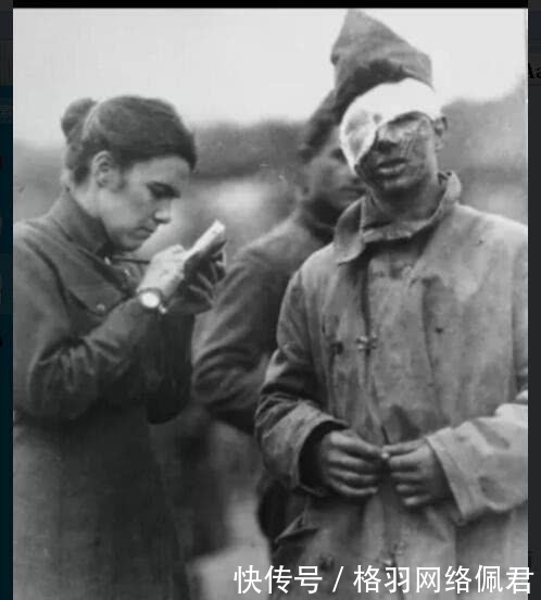 次世界大战|一战时期残忍老照片,士兵眼睛被毒气伤害,图6用骆驼运伤员