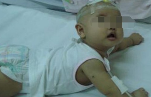 小珂|5岁男孩经常发烧,医生一检查是白血病,原来都是床单惹的祸