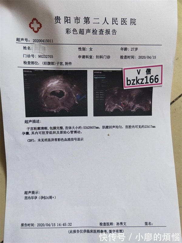 孕期做检查,B超检查or彩超b超报告单如何选