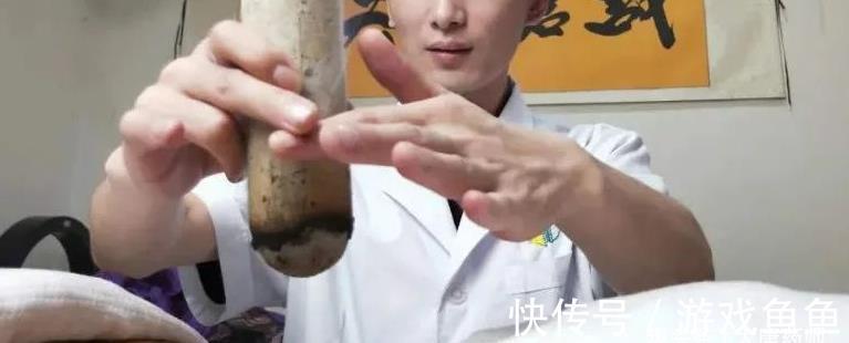 浊气|三伏化淤黄金期!灸4穴,调和气血,打通全身瘀血,预防各种结节