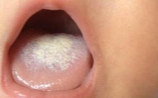 山药|吃一次胜过6斤苹果!体质差的娃若坚持吃,脾胃好,生病少