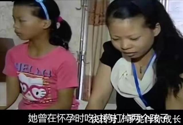 父母|女子怀孕吃打胎药,10岁双胞胎女儿长出喉结,母亲:出生就有问题