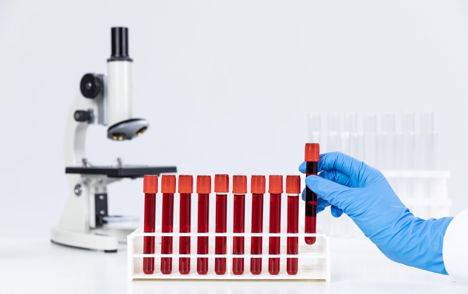 手术|胃癌手术不是一劳永逸,仍有复发风险,术后随访要重视