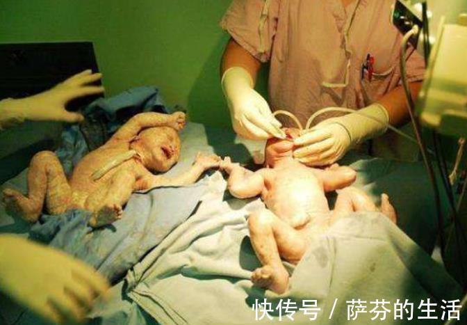 孩子|为何女人生孩子,娘家人必须要在场原因太现实!