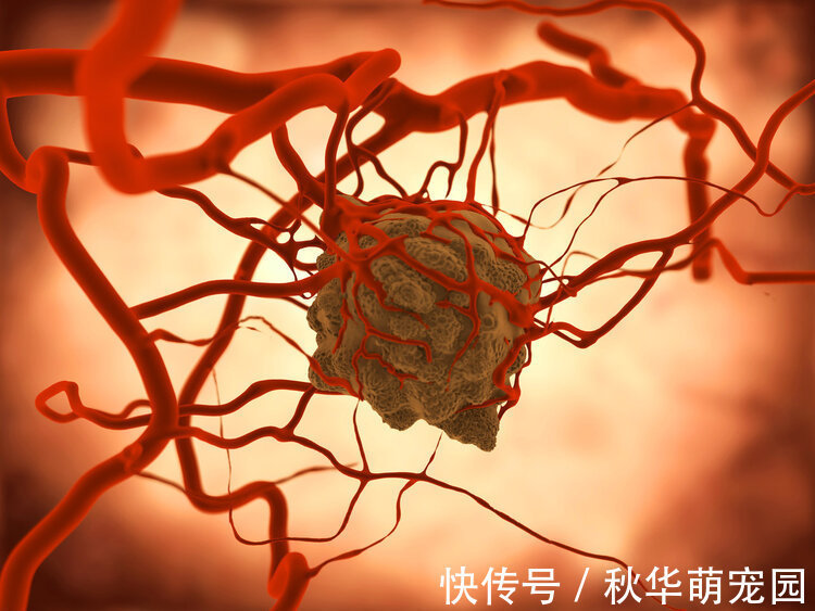 癌症患者|化疗后，患者的身体更差了？肿瘤医生不再隐瞒：4类患者不要化疗