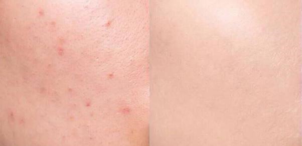 珀莱雅 薇娅力荐的粉底液,妆感轻薄自然又遮瑕,堪称平价粉底中的黑马!