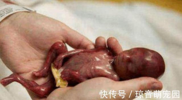 体重|在娘胎里只呆了22周的宝宝,出生时体重仅为245克,世界最小婴儿