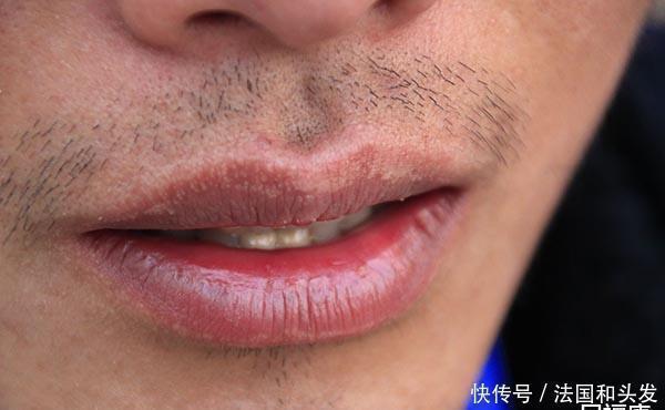 睡觉时出现3个异常，多半是血糖已经很高了，要重视，尽快降糖