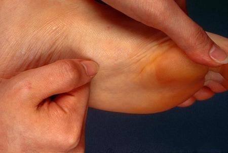 症状|手脚如果出现这些症状,你可能有高血糖了,再往下就是糖尿病