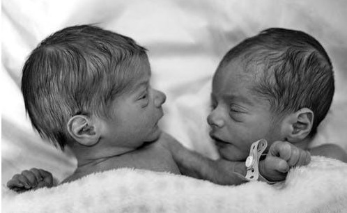 知识|双胞胎吵架生气，谁也不理谁背道而驰：关于双胞胎还有1个冷知识