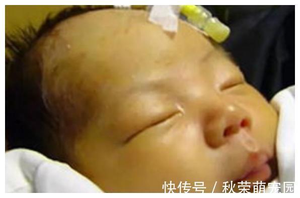 宝宝|儿科医生:想要宝宝出生没黄疸,孕期坚持“3不做”,别不当回事