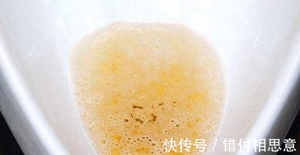 尿液|早起排尿留意第一泡尿,若属于这一种颜色,或是说明你的肾比较好