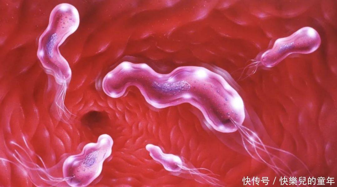 胃酸|胃痛、胃胀、反酸、嗳气、烧心还有溃疡，都有哪些药治？