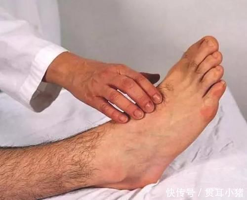 金鸡独立|血栓最怕你做3个动作,坚持做下去,你的血管干干净净