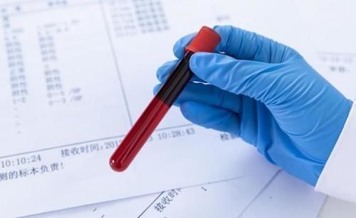 血常规|血常规可以看出是否患有癌细胞吗？听医生怎么说，不妨了解一下