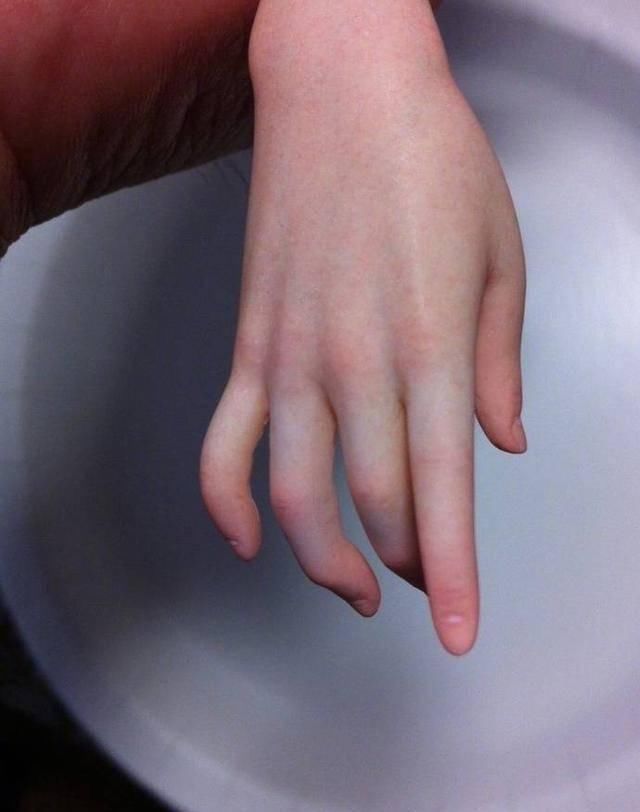 罗其胜|手办精细到血丝到底有什么用?就两个字“逼真”