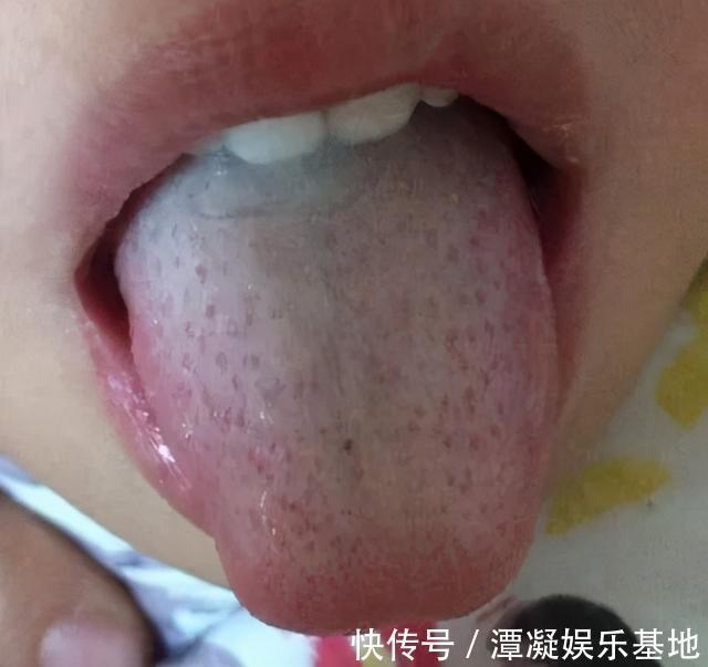 积食|奶奶带娃6年,孩子未见积食!医生:谨记这“2事”,脾胃壮如牛
