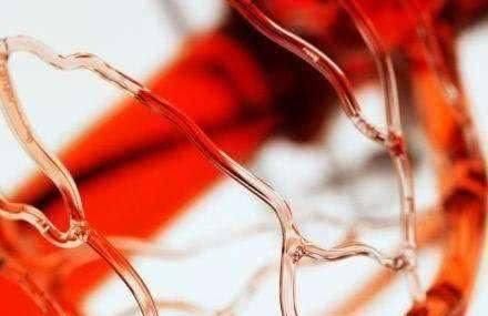 它是最便宜的血栓“溶剂”，伸手可拿，每天吃