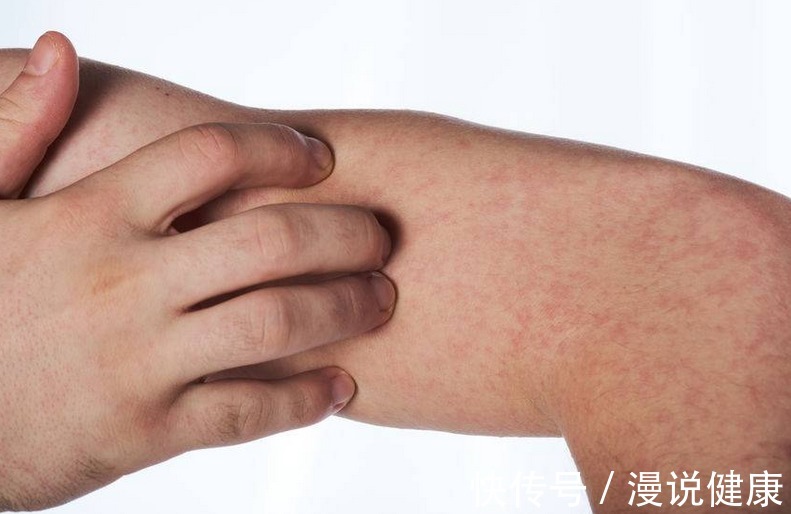 急性心肌梗死|血管堵塞危害不小,别急,能在早期坚持这些小动作,疏通血管不难