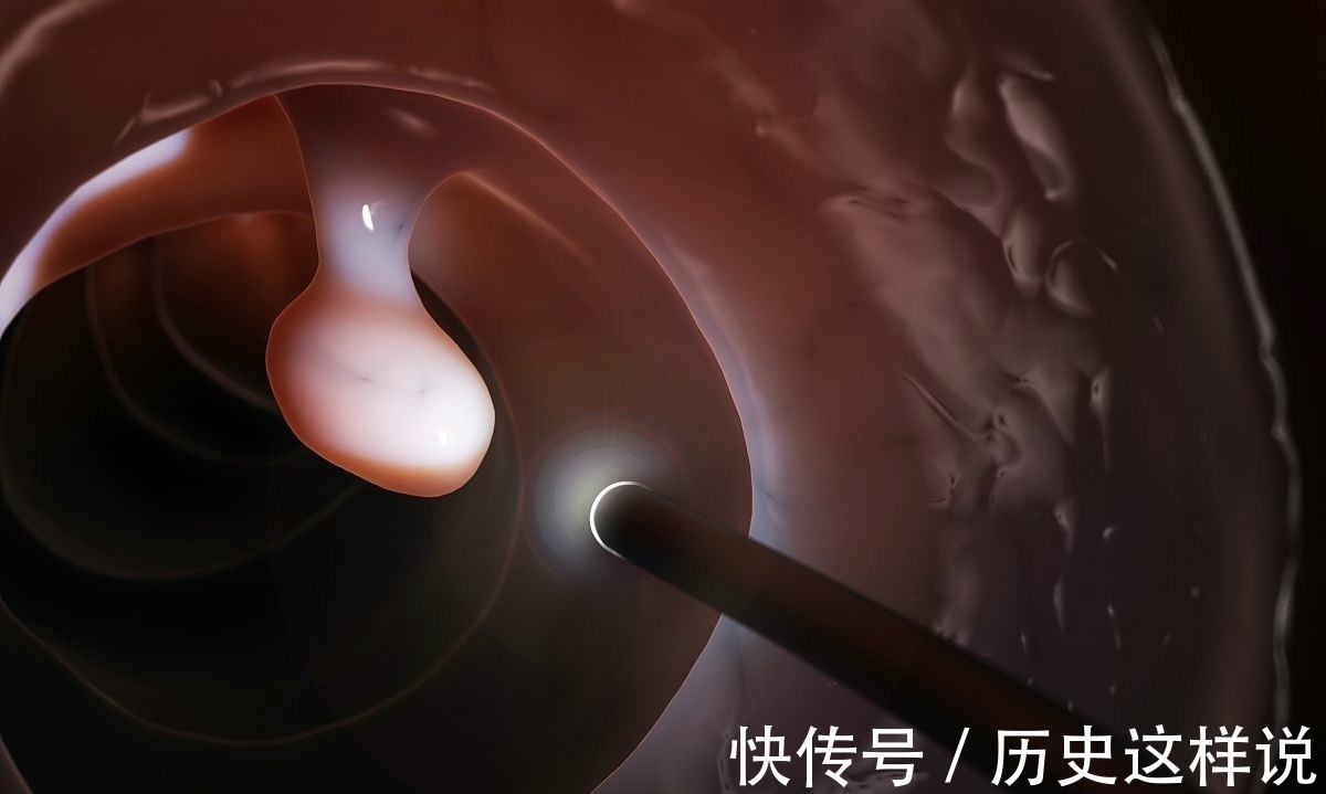 治疗|癌症一发现就是晚期,医生忠告,身体的四种小病最好及时治疗