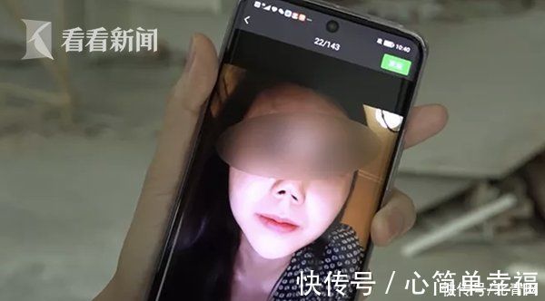 袁女士 美女变怪物?女子做手术整容 如今门都不敢出