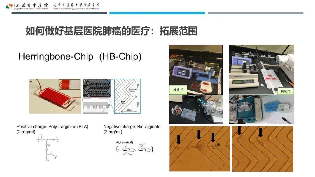 蔡婧|共谋江苏省基层医院肺癌未来发展之路